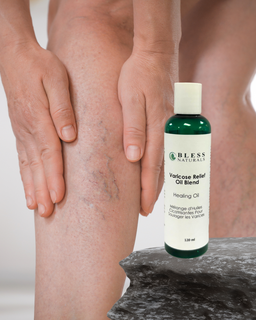 Varicose Relief Oil Blend 120ml